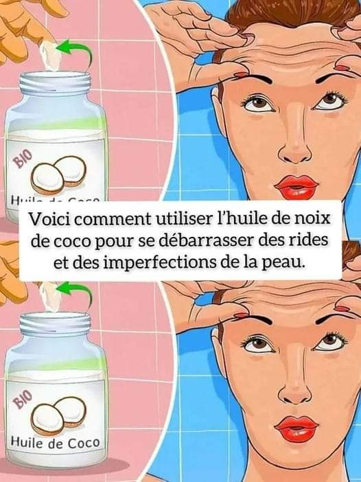 Huile de Coco