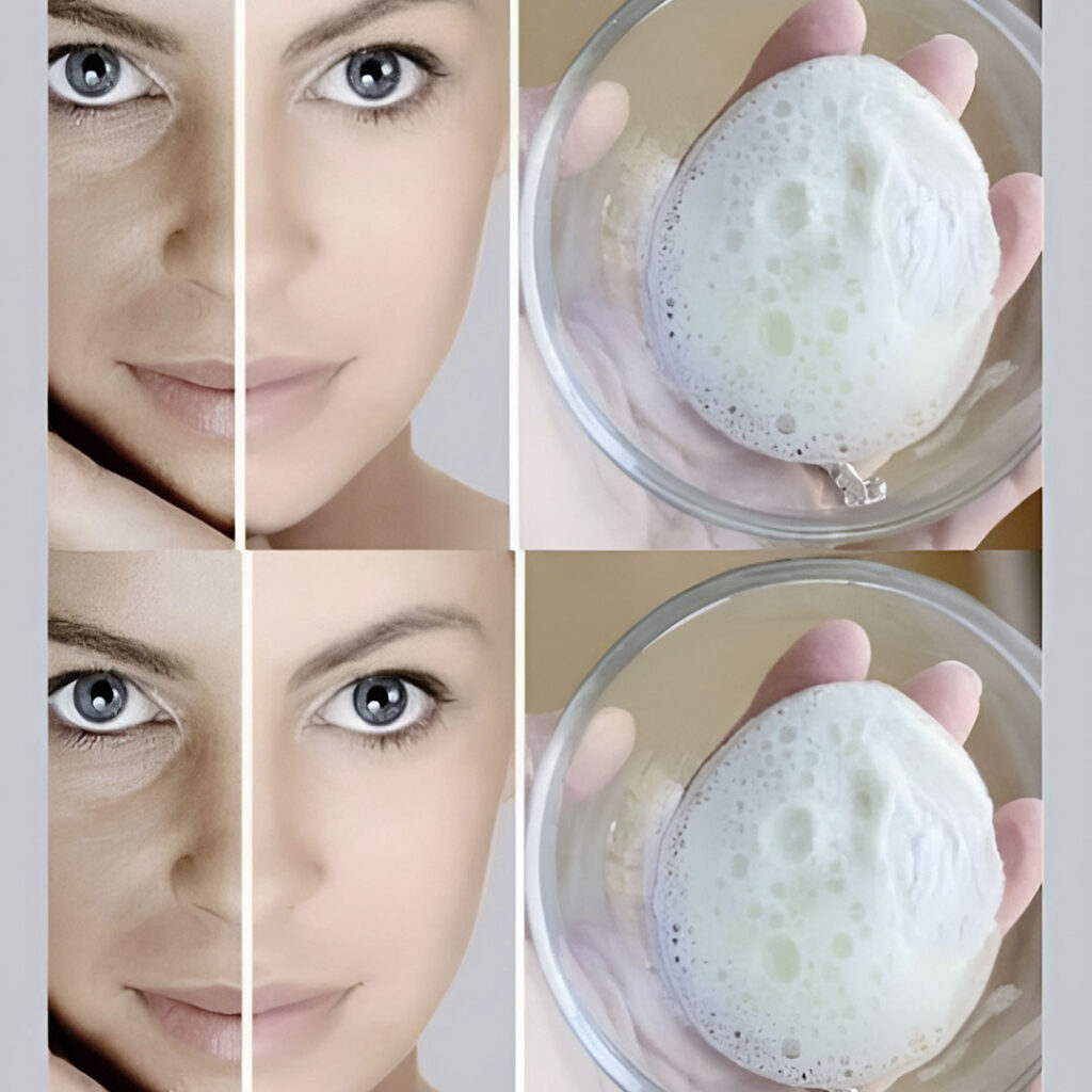 bicarbonate